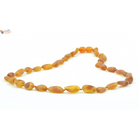 Cognac Amber Adult Necklaces in Bean Style